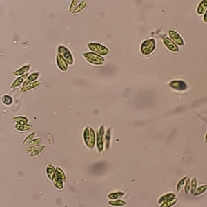 سندسموس Scenedesmus sp