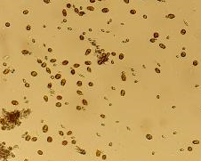 جلبک نانوکلروپسیس (nannochloropsis)