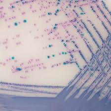 محیط کشت Chrom salmonella agar