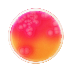 bacillus cereus agar base (محیط کشت باسیلوس سرئوس)